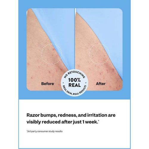 PeachSoothe® - Full Body Hair Solution